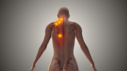 CBD topicals for pain illustration showing pain points on a human back